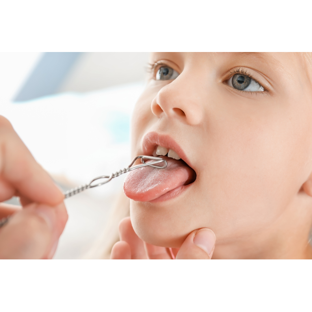 Fonoaudiología Odontológica - Nivel Intermedio